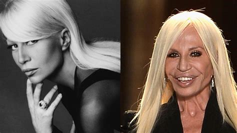 donatella versace ohne op